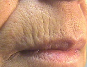 Before Care Esthetics Treatment